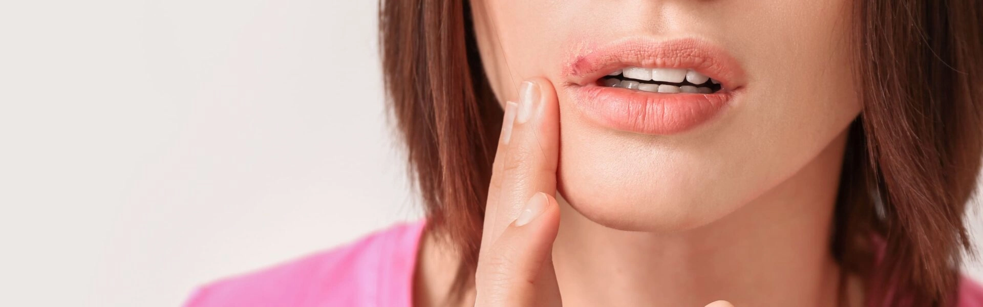 Ist Lippenherpes ansteckend?